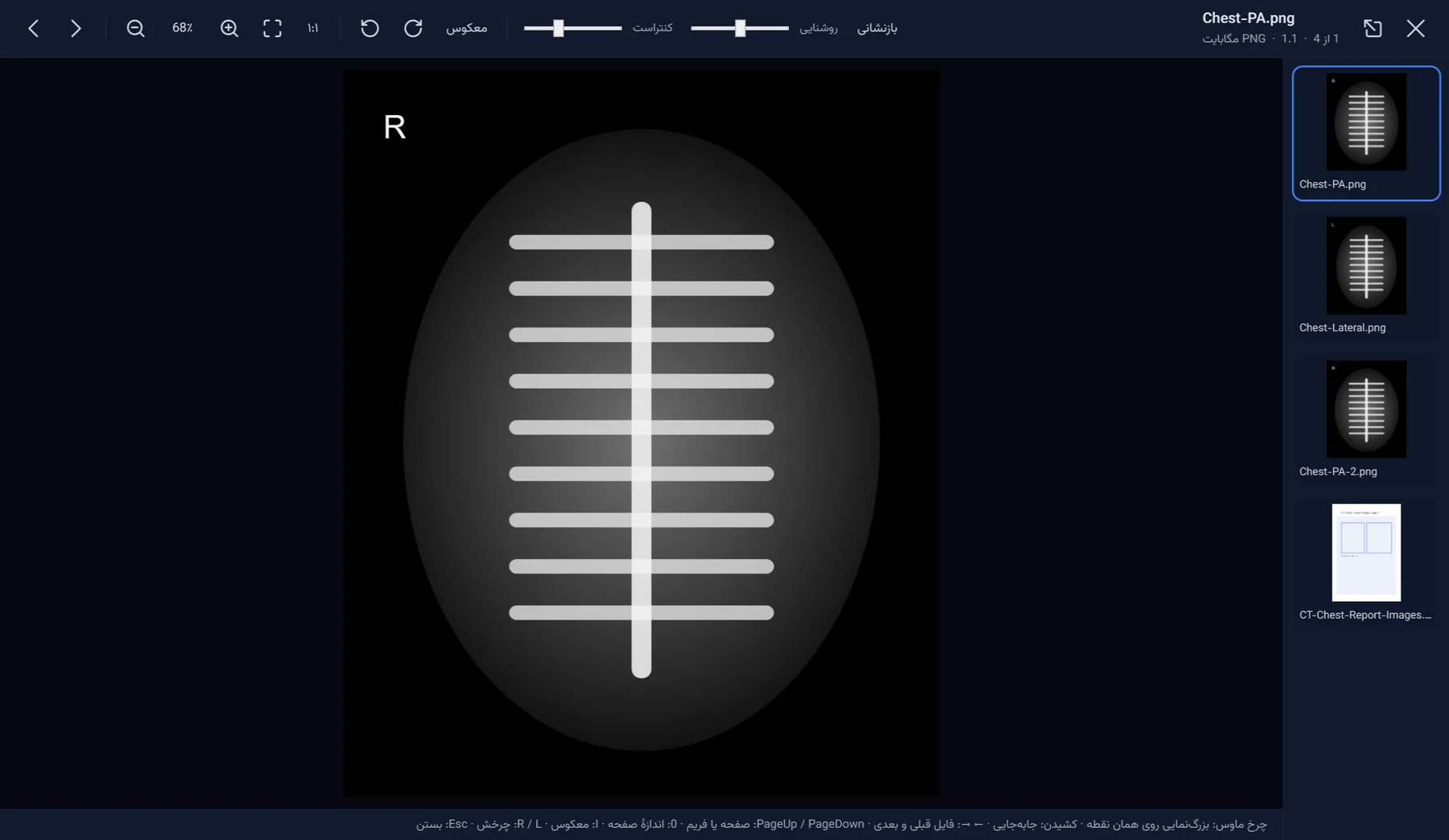 نمایشگر تصاویر DICOM و PDF در برنامهٔ پزشک